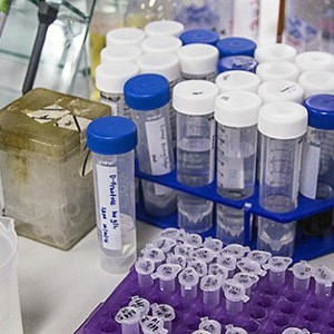 مختبرات كثيرة تنتج كميات كبيرة من المخلفات
البلاستيكية التي تُستخدم مرة واحدة